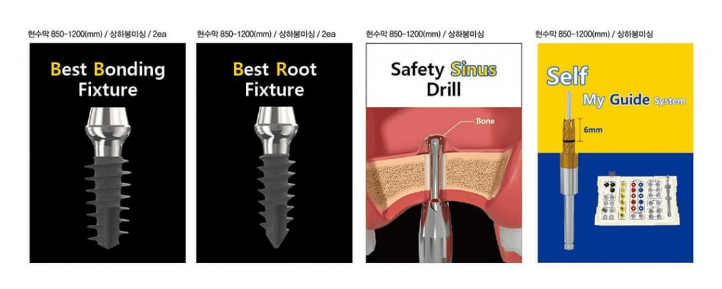 cấy ghép implant tức thì